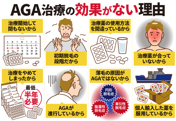 AGA治療の効果がない理由
