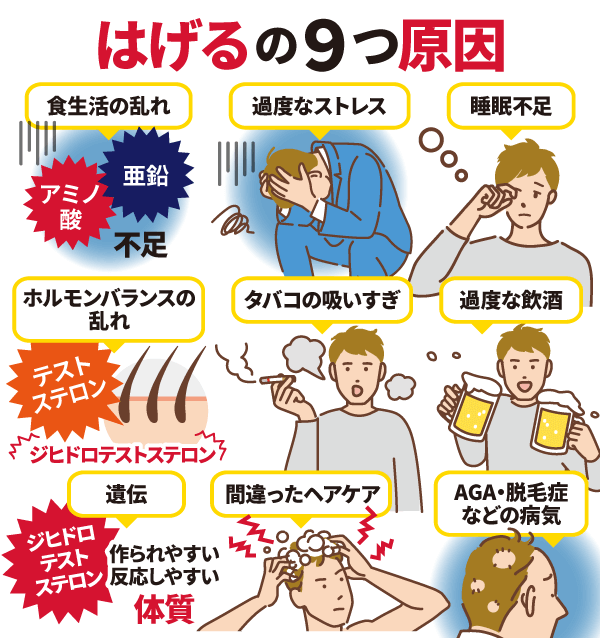 はげる原因はこの9つ