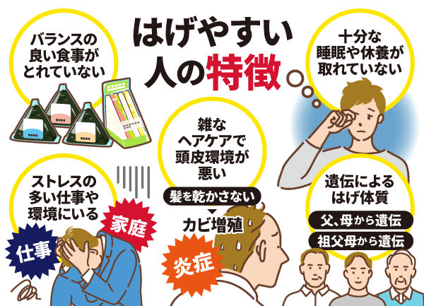 はげやすい人の特徴