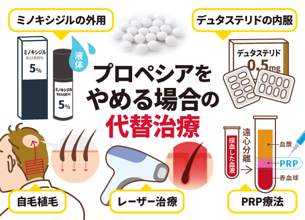プロペシア以外の治療法