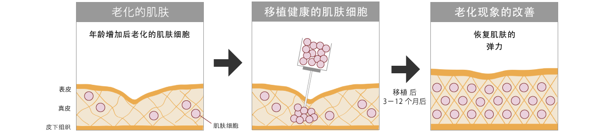 年龄增加后老化的肌肤细胞