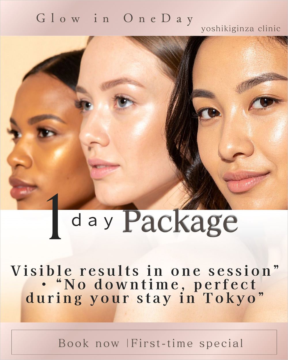 1day package