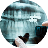 X-rays will be taken if necessary