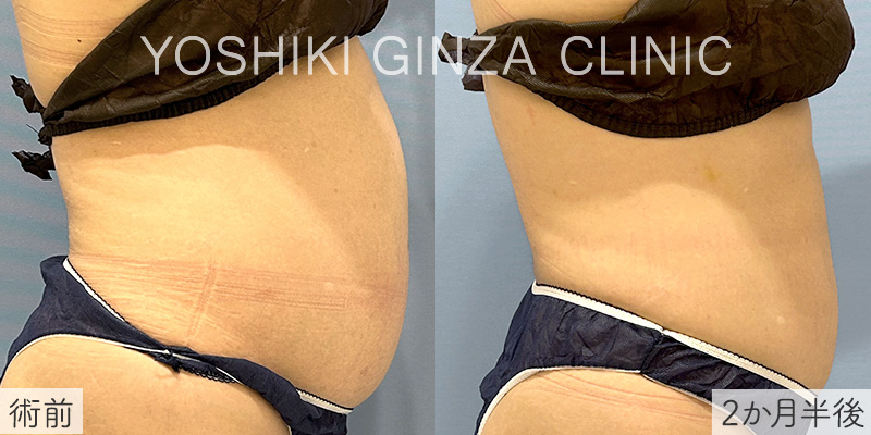 60代後半女性の成功例