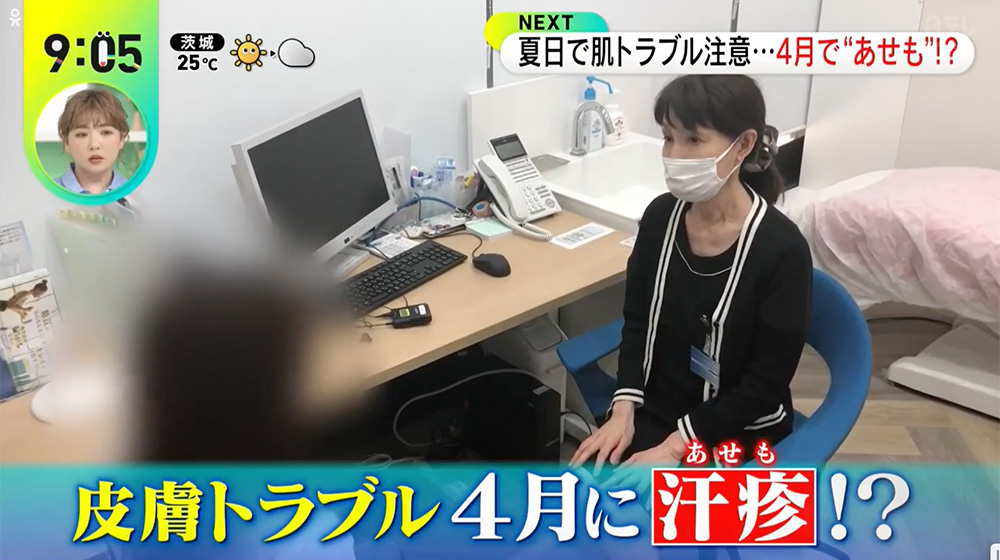 皮膚トラブル4月に汗疹!?