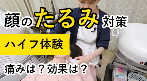 顔のたるみ対策「ハイフ体験」
