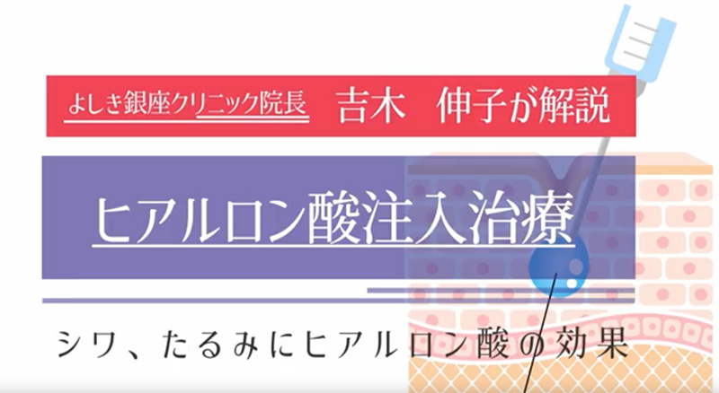 ヒアルロン酸注入～シワ、たるみの改善