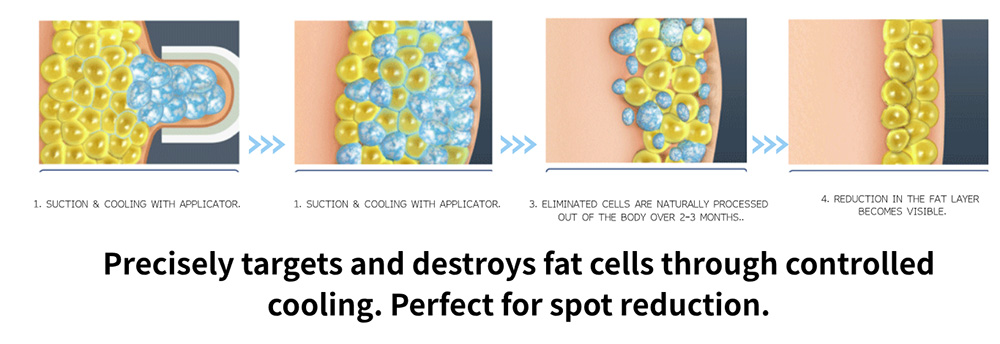 How Fat Cells Are Reduced – Mechanism
