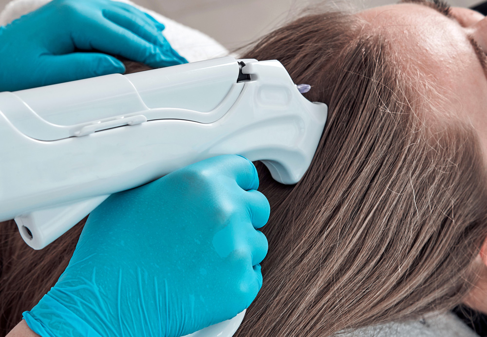 メソセラピー施術