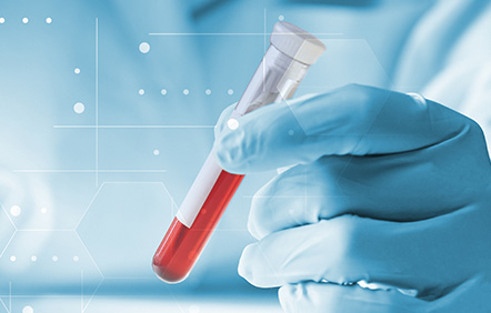 事前血液検査(感染症検査)