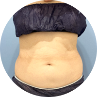 Before-and-after photos