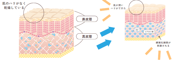 肌質改善ヒアルロン酸で肌の潤いとハリを向上