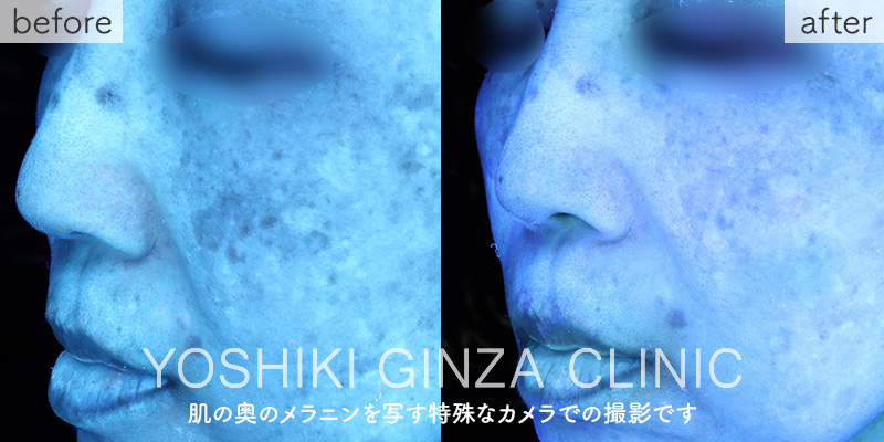 Mesona J Whitening: Mesona Yellow