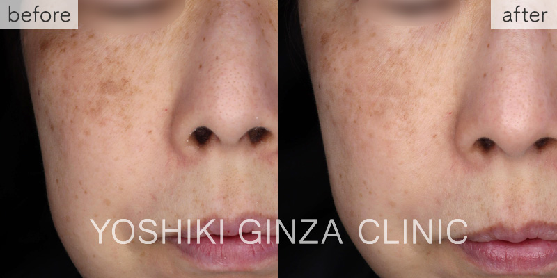 Mesona J Whitening: Mesona Yellow