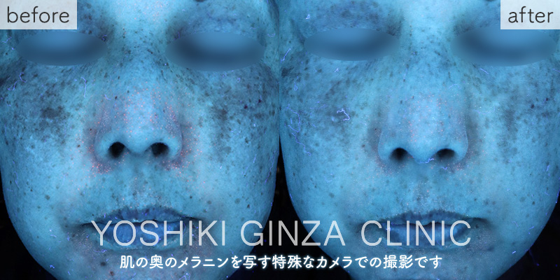 Mesona J Whitening: Mesona Yellow