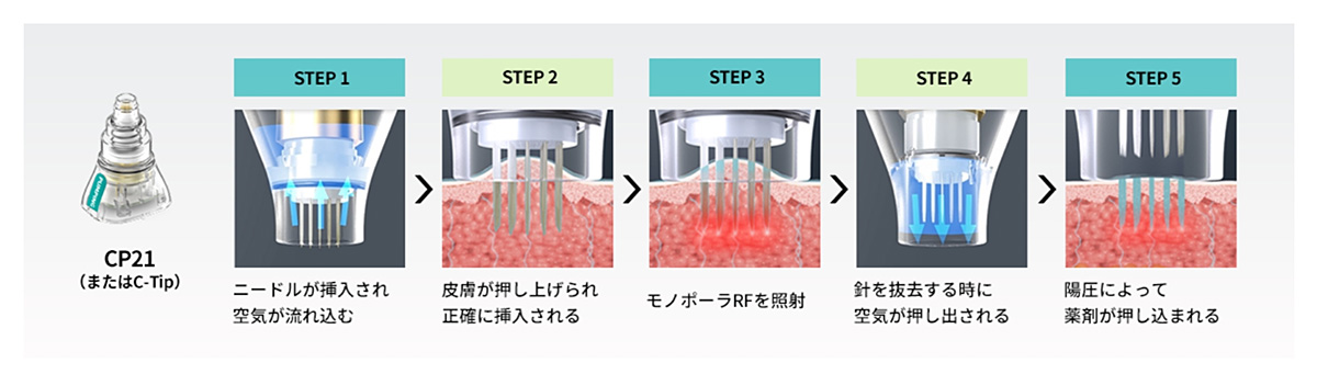 ドラッグデリバリーシステムの詳細