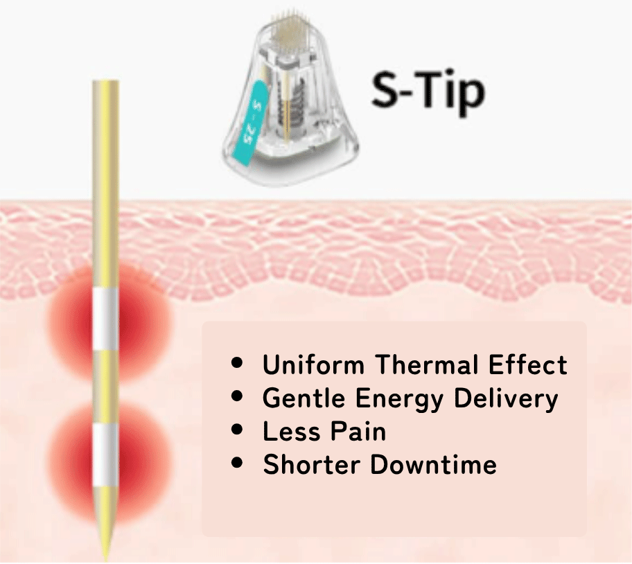 Mild Energy Delivery with Minimal Pain and Short Downtime