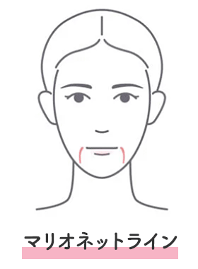 マリオネとライン