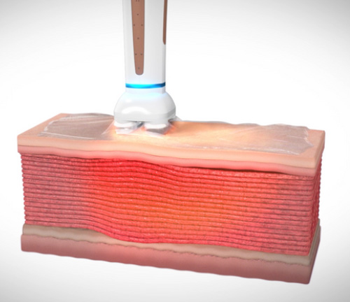 新しく改良されたヘッド