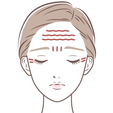 目尻・額・眉間のしわ