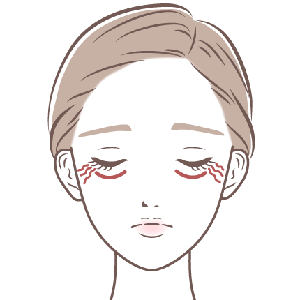 目の下のちりめんジワ・涙袋