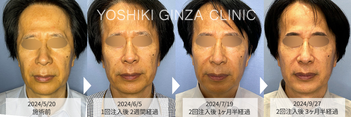 全顔の症例写真