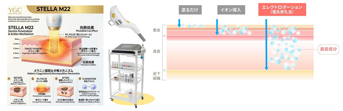 ステラ ✕ メソナJ