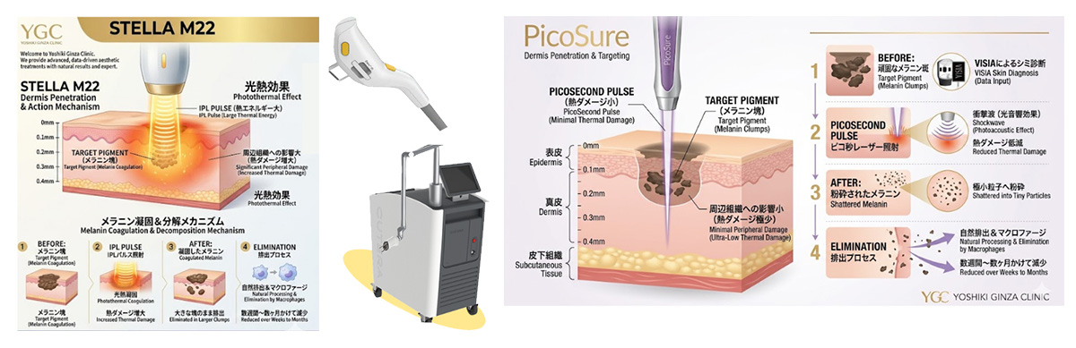 ステラ ✕ ピコスポット