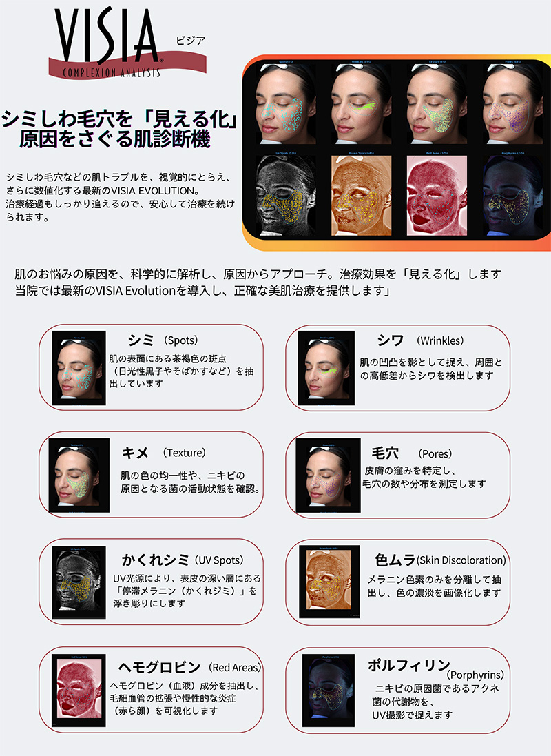VISIA肌診断