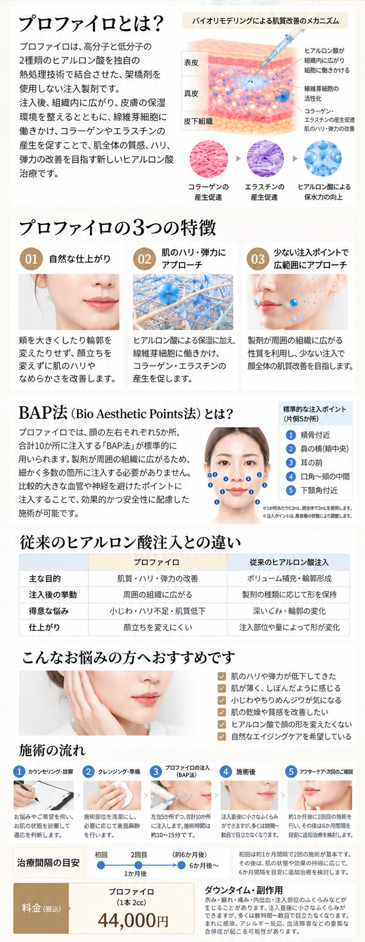 プロファイロ
