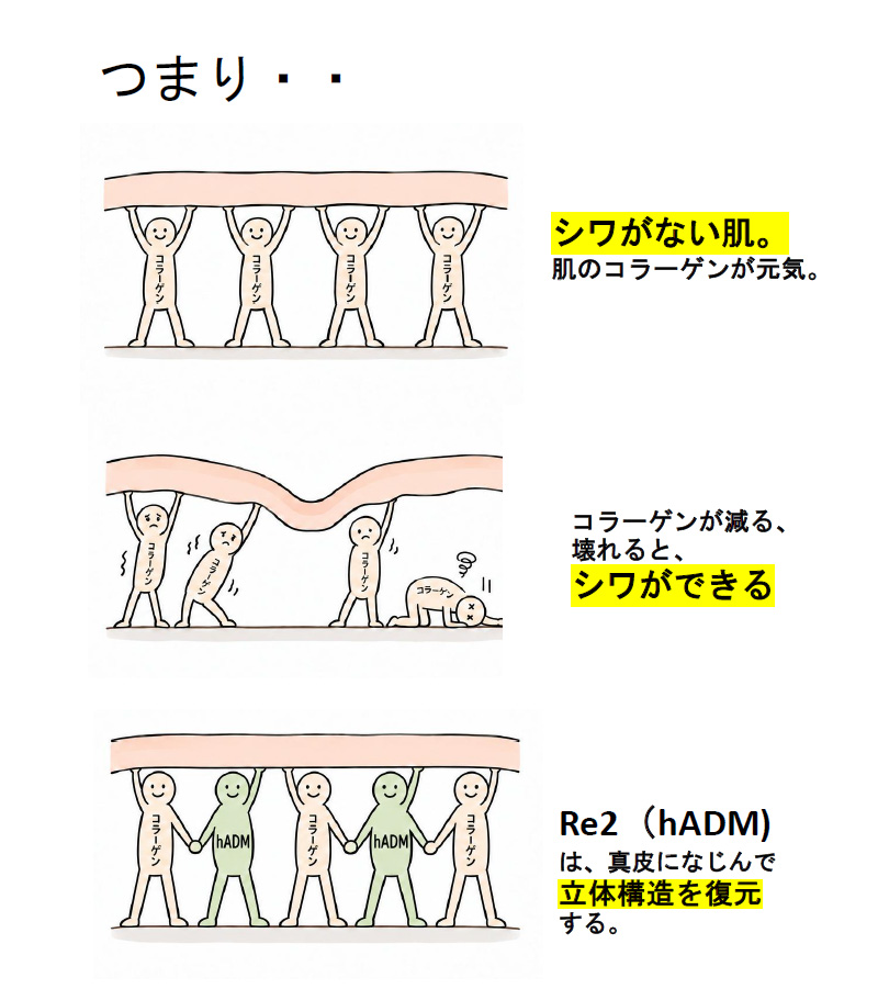 Re2O右ほほのみ2回注入4週後の症例写真