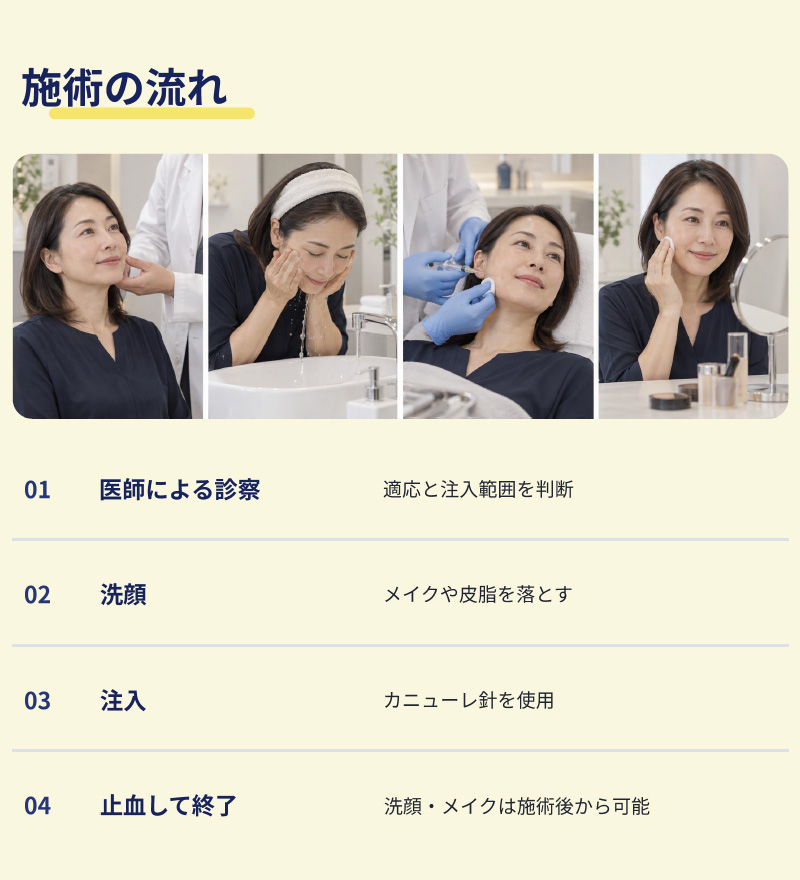 施術の流れ