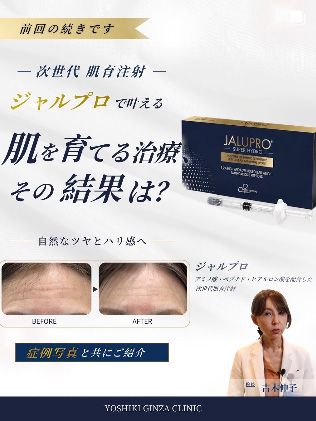 ジャルプロで叶える肌を育てる治療、その結果は?