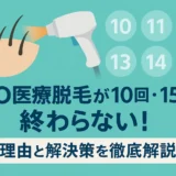VIO医療脱毛が10回・15回で終わらない！理由と解決策を徹底解説