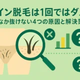iライン脱毛は1回ではダメ！なかなか抜けない4つの原因と解決策